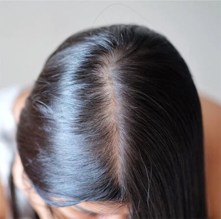 Red Onion – Food for Your Hair and Scalp