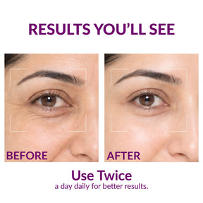Bio-Retinol Youth Radiance Serum